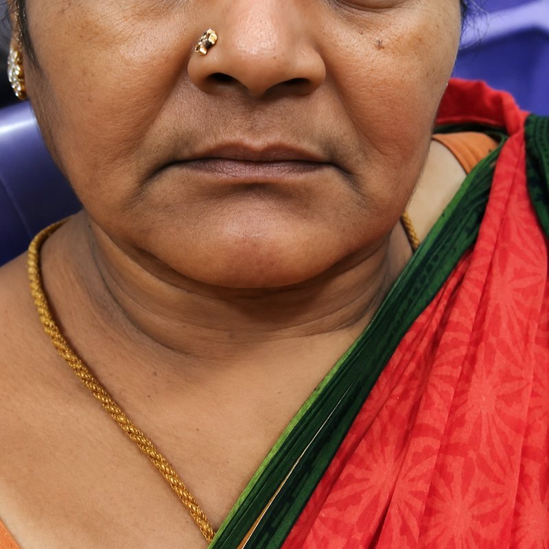 Patient smile before cosmetic dental restoration at Shanthi Dental Clinic