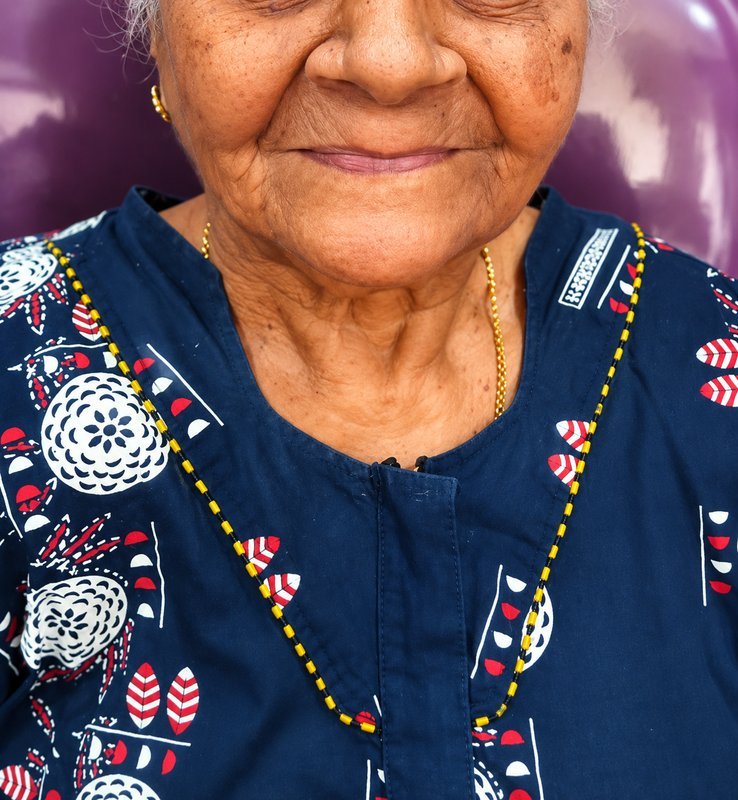 Patient before full denture treatment at Shanthi Dental Clinic